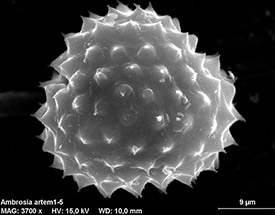 Common ragweed pollen (Photo by Marie Majaura via Wikimedia Commons, CC BY-SA 3.0)