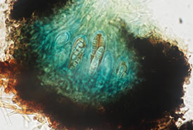 Opegrapha parmeliiperda, cross section of one fruiting body showing four-celled spores developing inside spore sacs; blue colour result of treatment with potassium hydroxide followed by Lugol’s iodine solution. (Photo courtesy of Kendra Driscoll)