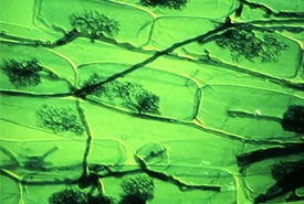 Mycorrhizae hyphae entering a plant cell (Public domain image)